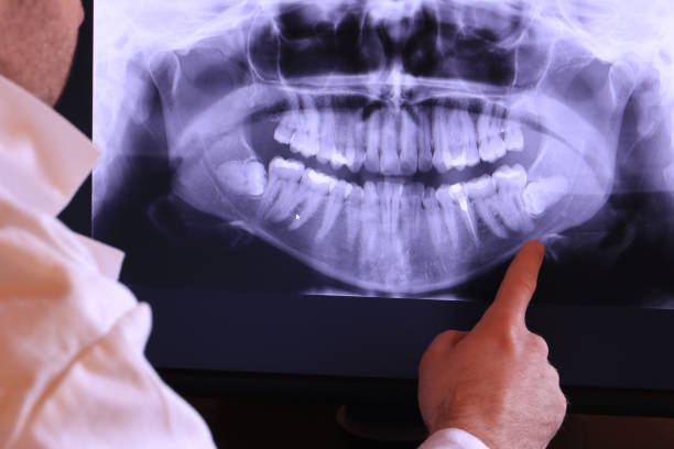 Best Tooth Infection Emergency Dentist  in Magnolia, NJ